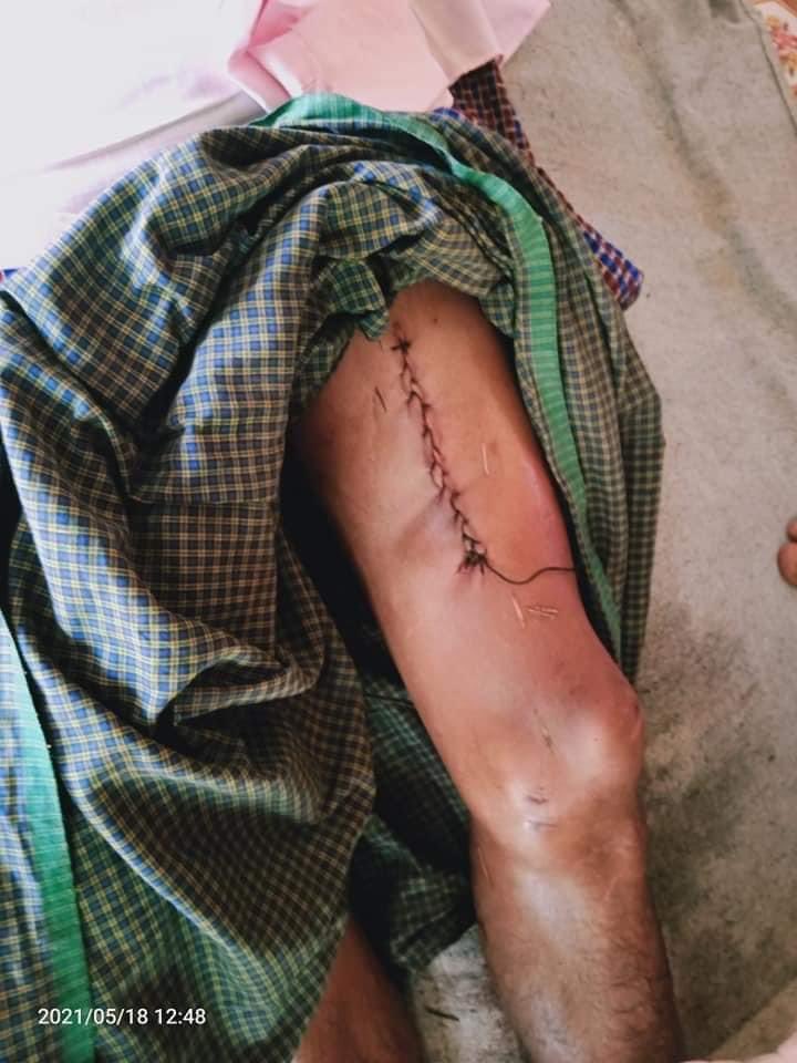 Haruonchill's tweet photo. tw // death
The body of U Kyaw Moe, 30yo father, who was SHOT DEAD by Junta Terrorists in Myothit(B) Ward, 5th St, #DaikU, Bago last night (May17) has been returned to his family. He’s shot in the arm &amp; leg and died of excessive blood loss. 
#WhatsHappeningInMyanmar
#May18Coup https://t.co/kTG3mjvPqq
