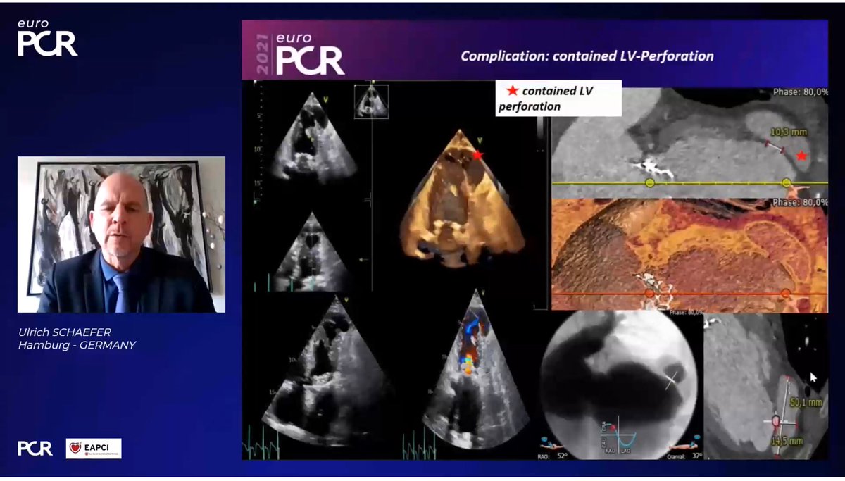 Great On-demand session at #EuroPCR showing how multimodality imaging can work together for the best patient outcomes 👏#echofirst