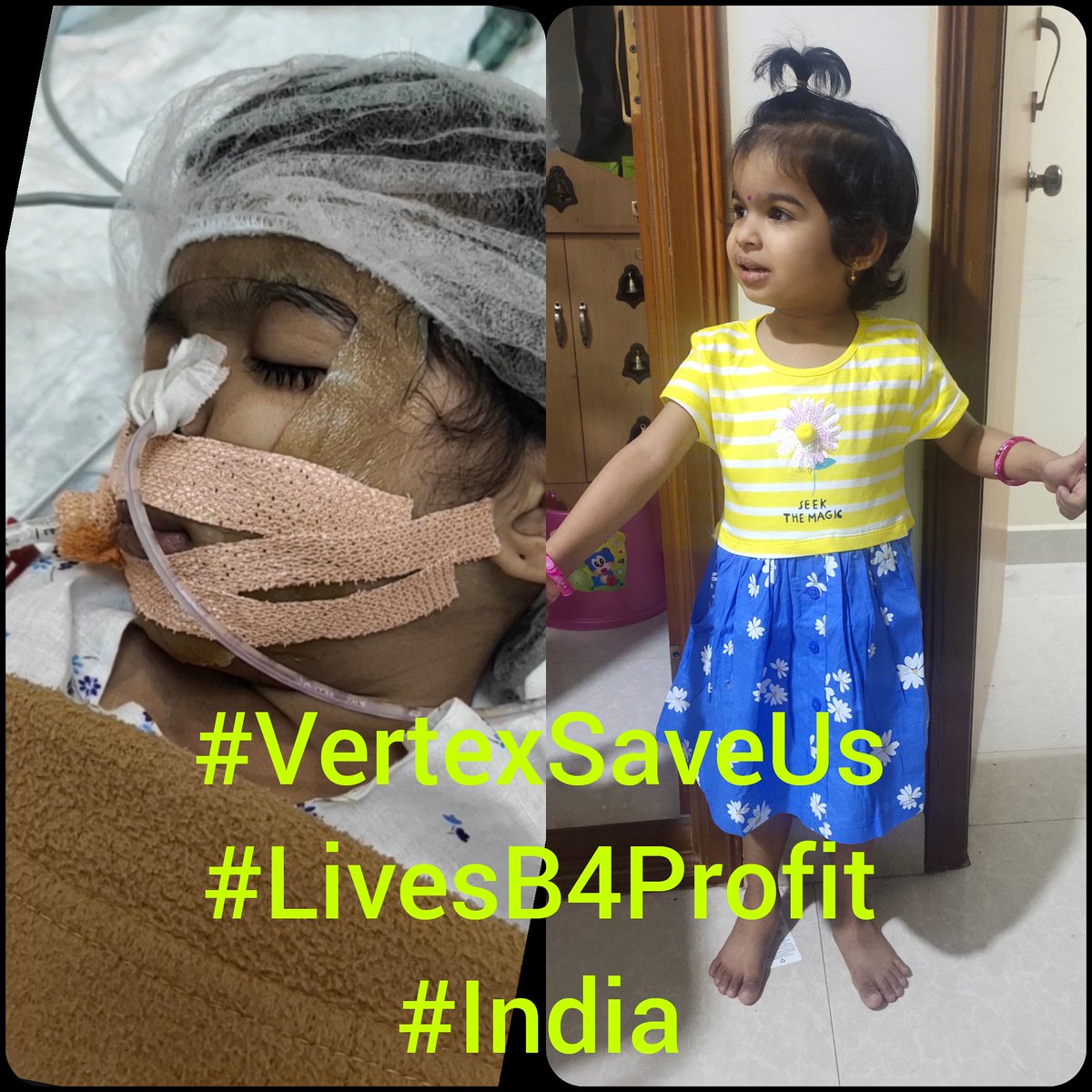 Vishaka's future would look so much brighter with access to <a href="/VertexPharma/">Vertex Pharmaceuticals</a>'s life-changing CF drugs

Two minute read👇👇

breathewithme.org/post/i-lost-my…

<a href="/JoleneinAfrica/">Jolene du Plessis</a> <a href="/TanyaKoorts/">Tanya Koorts</a> <a href="/CFbites/">Vaishnavi</a> <a href="/CFAware/">cf/Aware</a> <a href="/MonikaLutyCF/">Monika Luty</a> <a href="/starsindhu123/">SINDHUJA</a> #TrikaftaNOW #globalcfdrugs4all #cfawarenessmonth #India