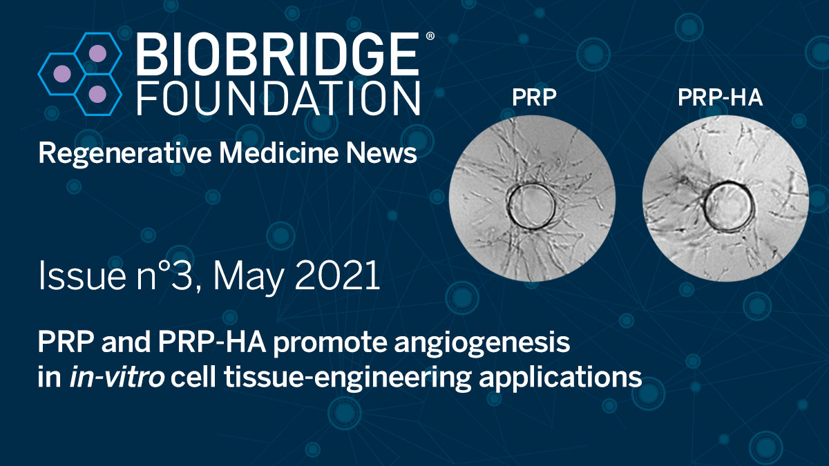 BioBridgeFDN's tweet image. Our third newsletter focuses on angiogenesis in in-vitro cell tissue-engineering applications. 
check out the online newsletter: bit.ly/2S08jk4
#regenerativemedicine #plateletrichplasma #cellularmatrix #prptreatment