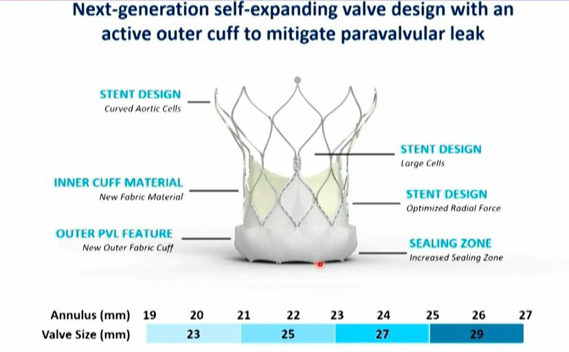vicentejmzmd's tweet photo. @AbbottCardio new generation self-expanding THV "Navitor" with a sealing cuff for reducing PVL, large cells design for easier coronary cannulation, and good valve hemodynamics on 30-day follow-up study presented at
#EuroPCR @PCRonline https://t.co/cNPQiWEyQI
