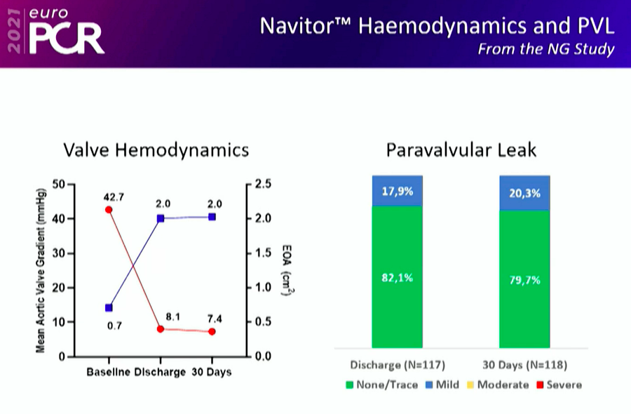 vicentejmzmd's tweet photo. @AbbottCardio new generation self-expanding THV "Navitor" with a sealing cuff for reducing PVL, large cells design for easier coronary cannulation, and good valve hemodynamics on 30-day follow-up study presented at
#EuroPCR @PCRonline https://t.co/cNPQiWEyQI