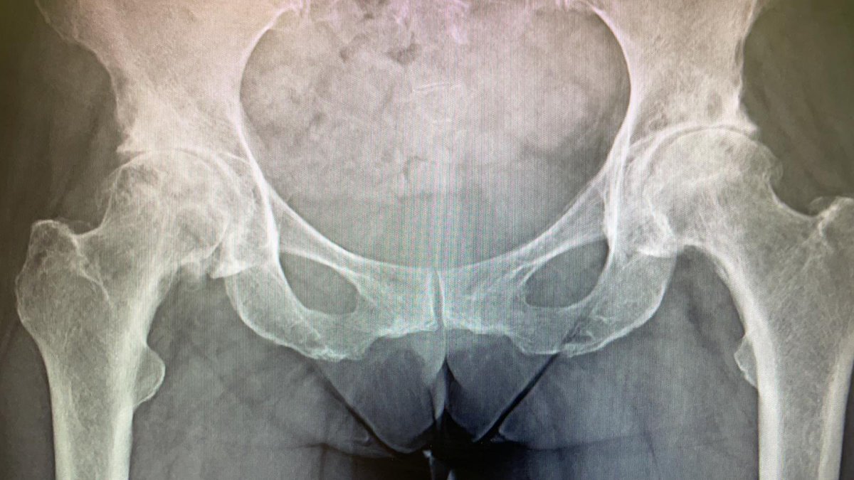 Exeter Hip Unit tweet media