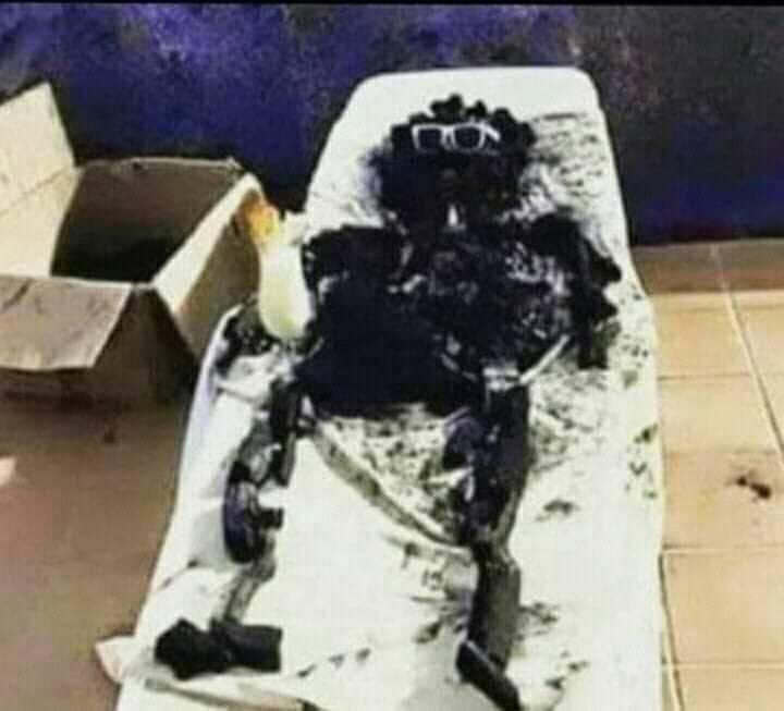 <a href="/ay000d/">ابن تعز🇾🇪</a> كان بي سطح البيت مسترخي وشرقت عليه الشمس واحرقته 

كيف حاااااااااالك 😂😂😂😂😂😂😂😂😂😂😂😂😂😂😂😂😂😂😂