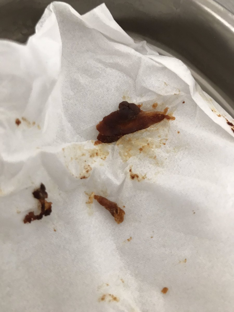 WaterlooEar's tweet image. Ear Wax Removal @WaterlooEar 
Tel: 07923273618
@CrosbyBubble @SeftonBubble @Seftonhour @MerseyHour @HightownVillage 
#earwaxremoval #microsuction #liverpool #merseyside #earwax #sefton