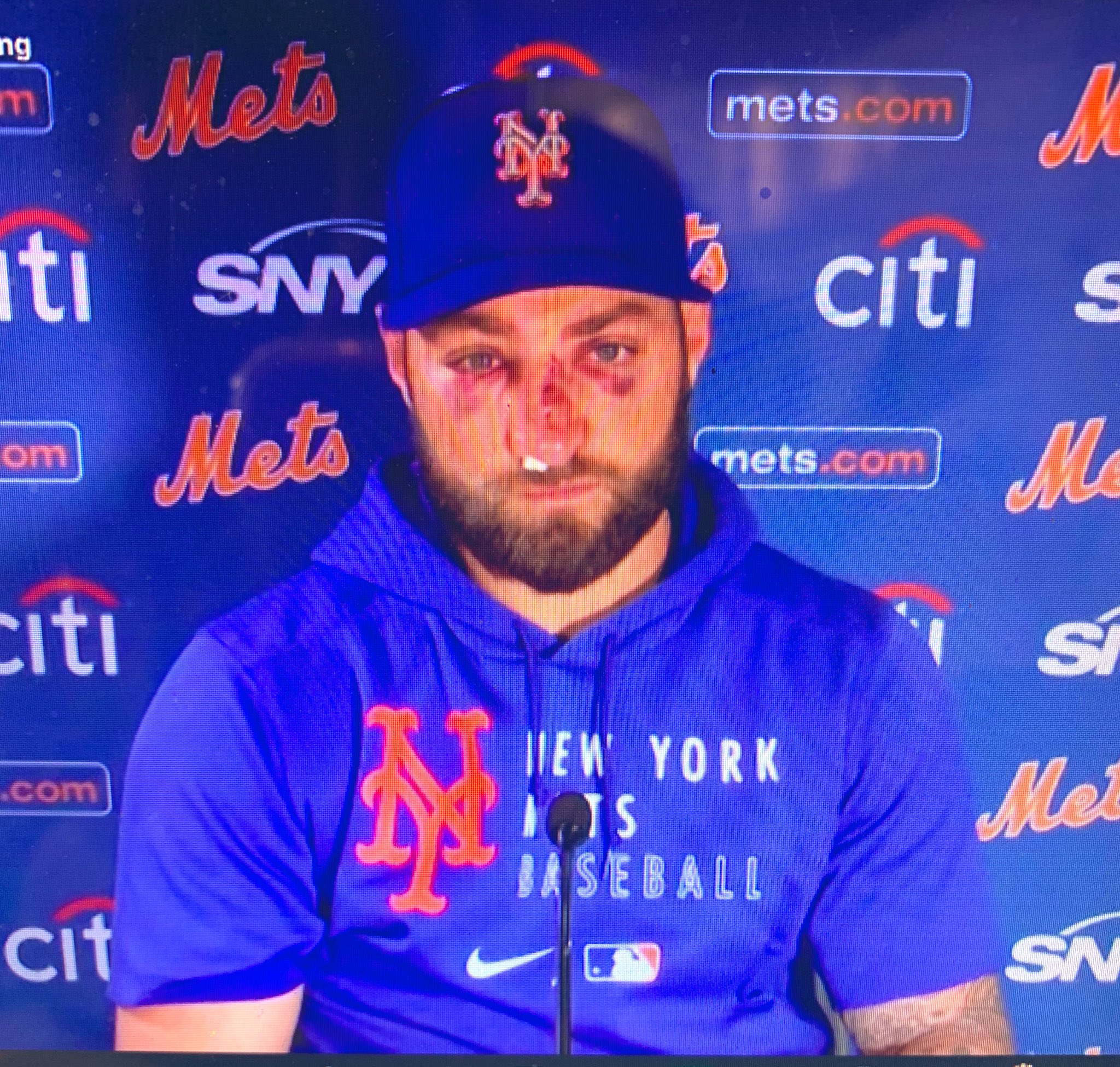 Tina Cervasio on Twitter: An emotional #Mets Kevin Pillar says he's having  trouble breathing out of nose, has continued eye swelling, but feels fine.  He says he “feels sad” though for his