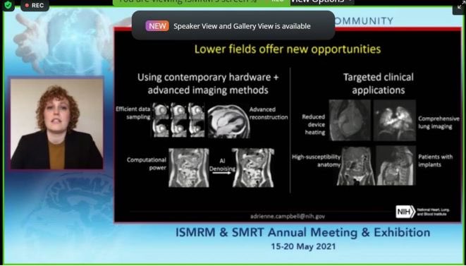 Congrats to ⁦@ACampbell_MRI⁩ for an awesome talk in the ISMRM plenary on the potential of low field MRI for interventional, cardiac, lung, and other applications. Amazing overall session!⁦@ISMRM⁩ ⁦@TheBethesdaLabs⁩ ⁦@MRInicole⁩ ⁦@RajivRamasawmy⁩