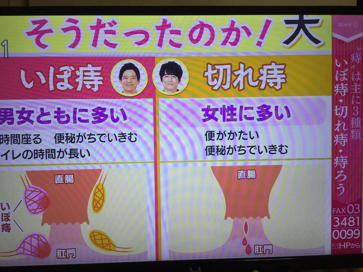 爽やか カッコ良すぎる Nhk若手アナが下半身麻酔で痔ろうの手術を受けながら実況 退院までの2週間を 痔 撮りレポート あさイチ Togetter