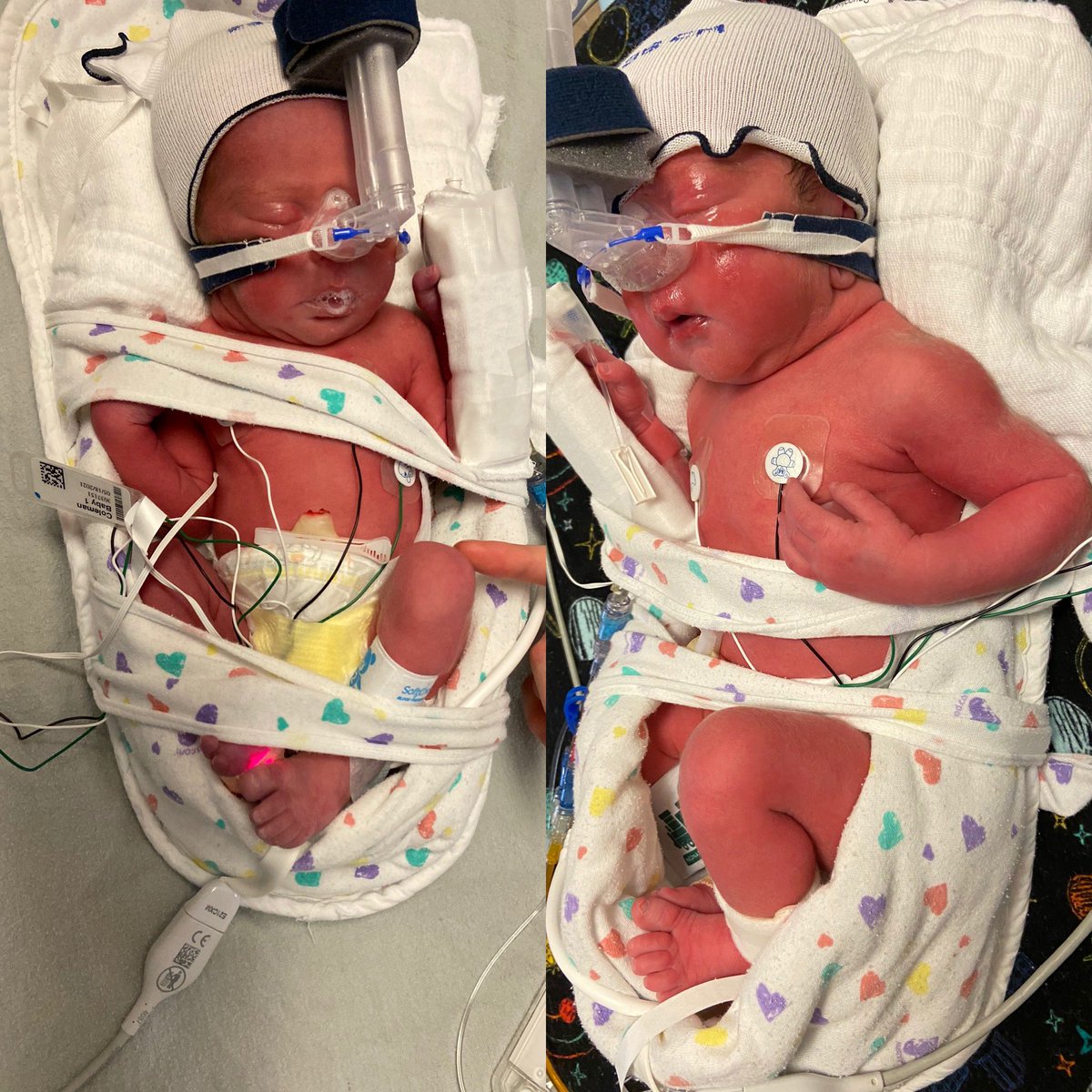 JuliaEColeman's tweet photo. Announcing the arrival of our boys. They are holding on in the NICU. I promised them cars if they could wait until session was over, so I guess I have 16 years to save up. 🚙🚙 https://t.co/kgl11kAJj5
