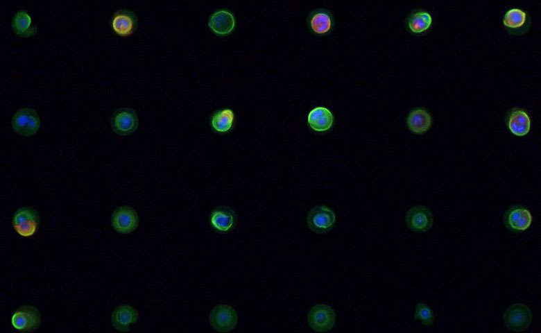 Human #keratinocytes on 50 μm micro-patterned substrates stained for Keratin 14 (green), #transglutaminase 1 (red), and DAPI (blue). Captured on the #Operetta by Ph.D. student Blaise Louis (<a href="/blaisemlouis/">blaise.</a>) #SkinCells