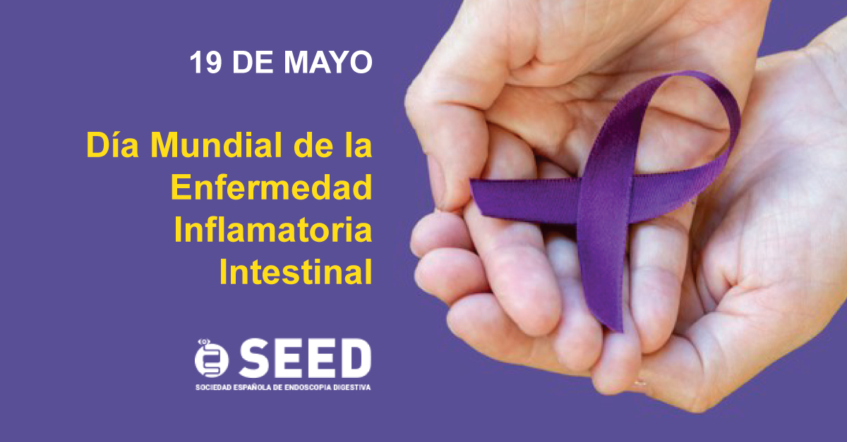 SEEDendoscopia's tweet photo. Hoy es el Día Mundial de la Enfermedad Inflamatoria Intestinal, #EII, que afecta a 5 millones de personas en todo el mundo e incluye 2 enfermedades crónicas con periodos de remisión: la Enfermedad de Crohn y la Colitis Ulcerosa  
#worldibdday2021 #DíaMundialDeLaEii https://t.co/VwL9iQsKyc