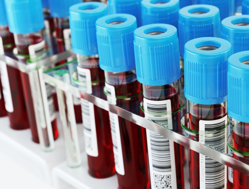 Cn1699's tweet image. Massive blood sampling study identifies predictors of Alzheimer&apos;s risk

#bloodsampling #alzheimers 

For more information | ⬇️
buff.ly/3bD5SuM