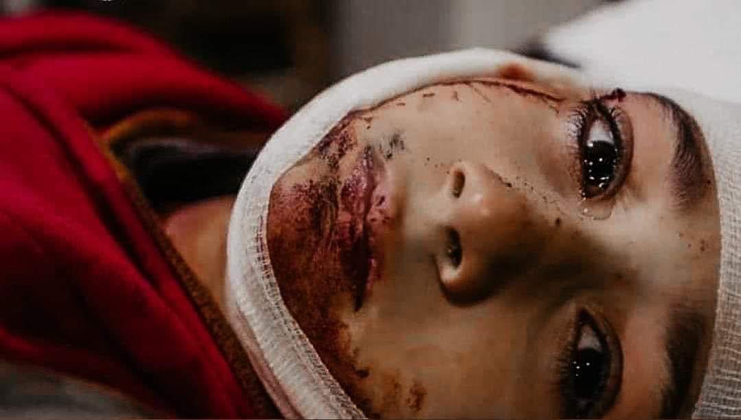 prettylupins's tweet photo. Never felt so heartbroken, destroyed and keep crying for the people in Palestine. How scared the kids would be during the air strikes and seeing all these kids dying.. Ya Allah, my heart is so restless 💔😭 #GazaUnderAttack 
Don't #SupportIsrael or #VisitIsrael they're inhuman! https://t.co/3NSMbKD9Bs