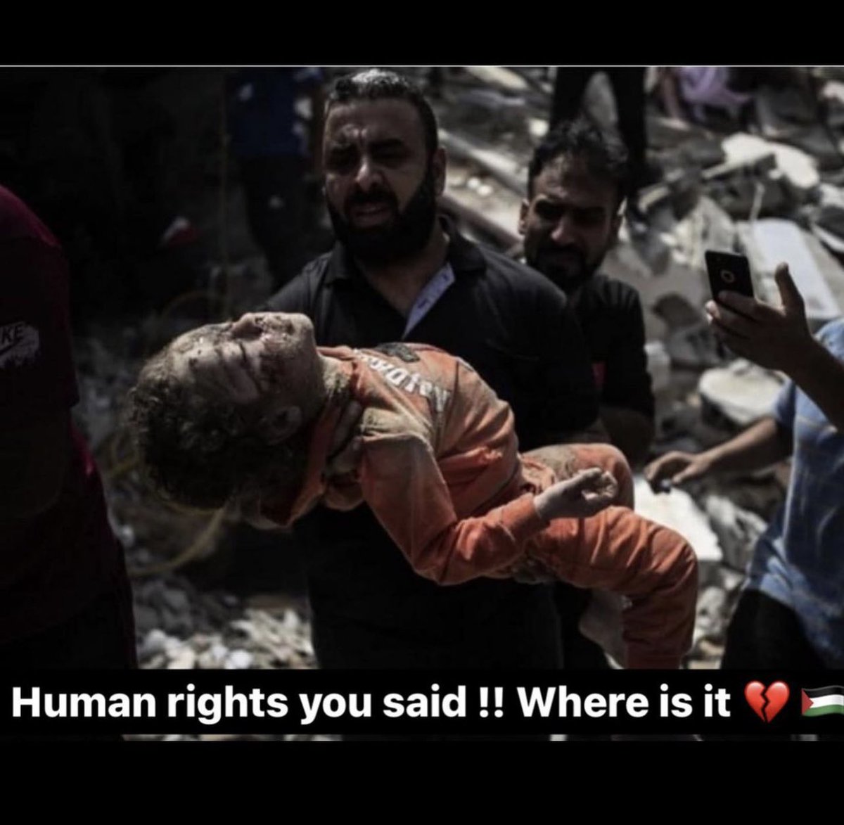 QaqSawsan's tweet photo. This is what people in #gaza have to face every day, this is how they are dying!🇵🇸 where is the Justice! They have the right to live well!!! 💔🇵🇸 #GazaUnderAttak #Palestine #IsrealiTerrorist #IsrealExposed #IsrealCrimes #Netanyahu_is_lying #FreePalestine https://t.co/JvYCsDnJkz