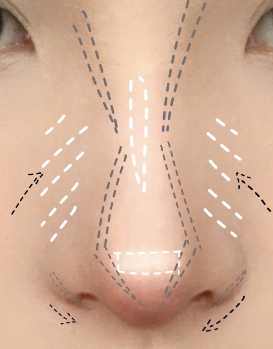 ยังไม่เคยใช้คอนทัวร์ลงแบบนี้แต่เคยลองเอาคอนซีเลอร์ลงแบบในรูป จมูกพุ่งมากกกกกกก