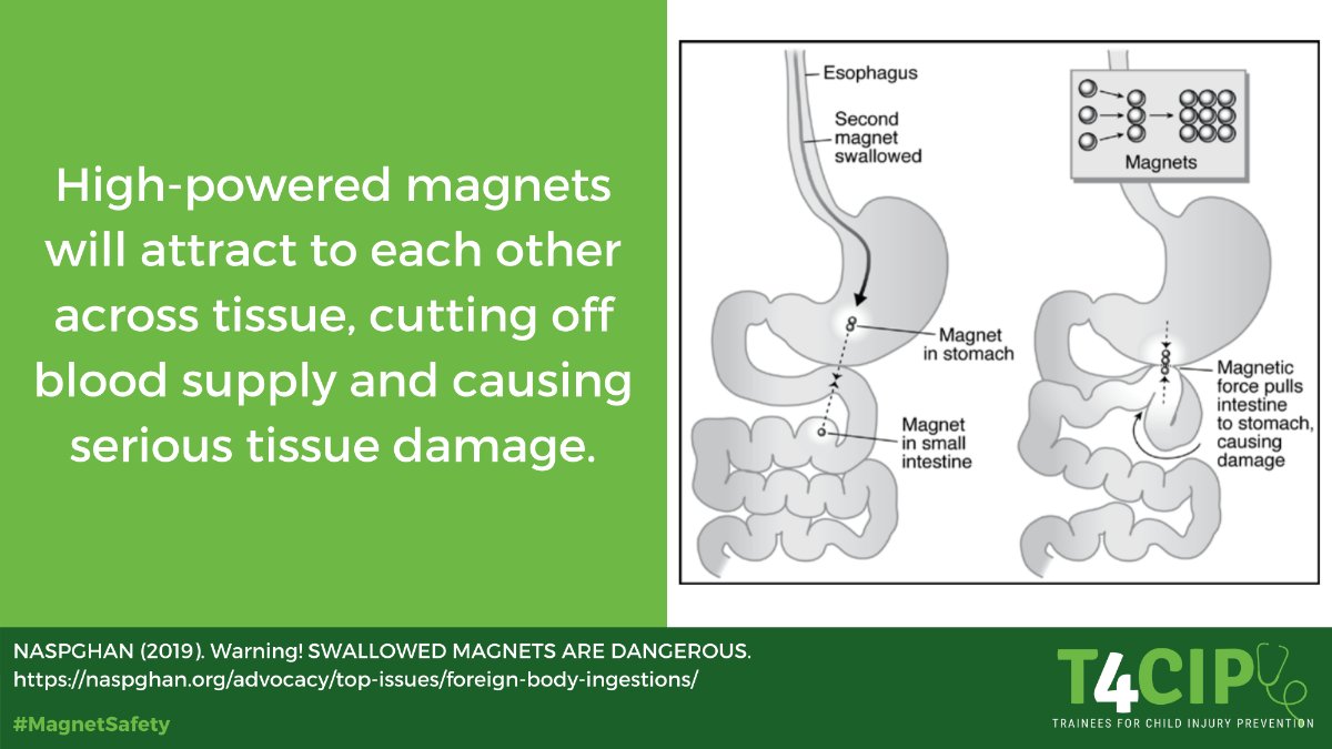 Did you know... #MagnetSafety #T4CIP