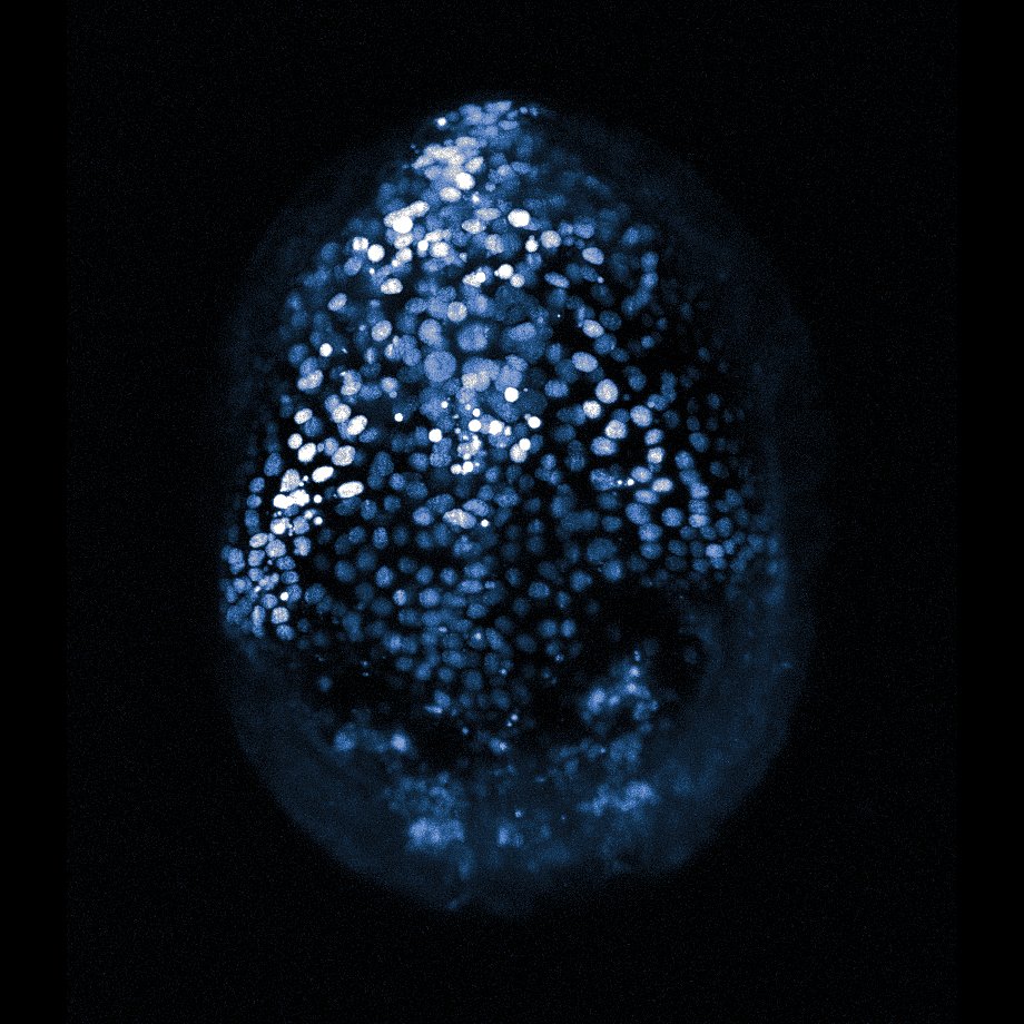Flamingo Project (@microflamingo) on Twitter photo A T-SPIM Flamingo #lightsheet microscope has landed at <a href="/MBLScience/">Marine Biological Laboratory (MBL)</a>. Carsten Wolff has already tested our setup with a developing Parhyale hawaiensis embryo. We're looking forward to many more images and feedback from local faculty and course attendees! A T-SPIM Flamingo #lightsheet microscope has landed at <a href="/MBLScience/">Marine Biological Laboratory (MBL)</a>. Carsten Wolff has already tested our setup with a developing Parhyale hawaiensis embryo. We're looking forward to many more images and feedback from local faculty and course attendees!