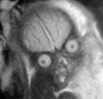 The real reason they discourage MRIs during pregnancy is because then people would realise they’re incubating nightmare demons and would be rightfully terrified