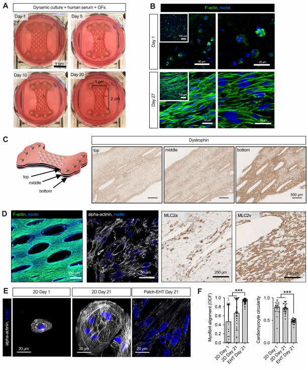 Human Engineered Heart Tissue Patches Remuscularize the Injured Heart in a Dose-Dependent Manner! Learn more: ow.ly/FYxh50EOnUf #AHAJournals <a href="/t_studemann/">Tim Stüdemann</a>