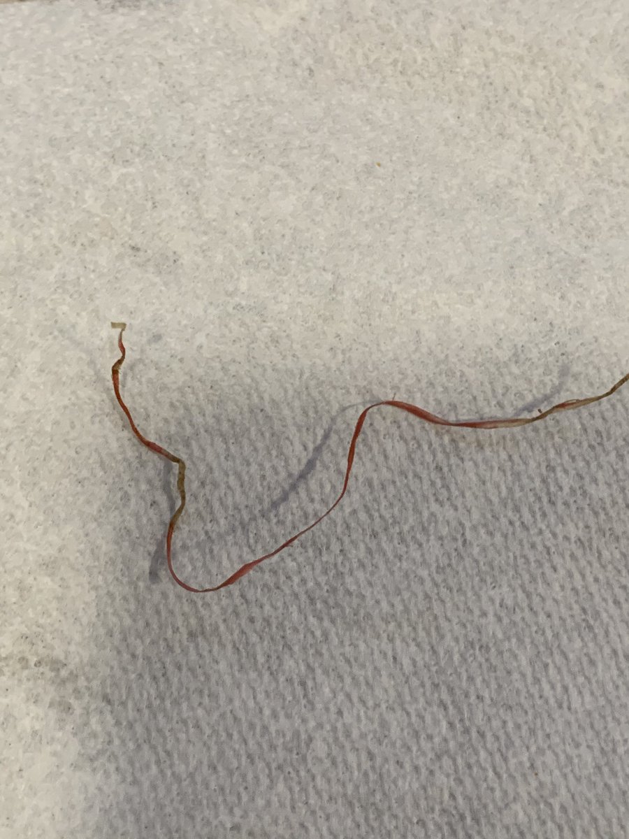 ValiMeet's tweet photo. @Applebees found this twine like textured  in my blackened shrimp fettuccine. What is it? https://t.co/v4GjdA4ZLI