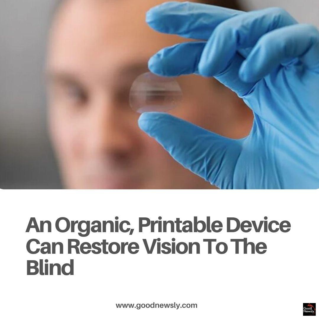 goodnewsly's tweet image. A printable device that's being developed by a researcher at the University of Sydney can serve as a retina to blind people and could restore sight.

Full story

@medicalxpress

@Sydney.edu

   #artificialretina #eyedoctor #eyesurgery #Science

goodnewsly.com/an-organic-pri…