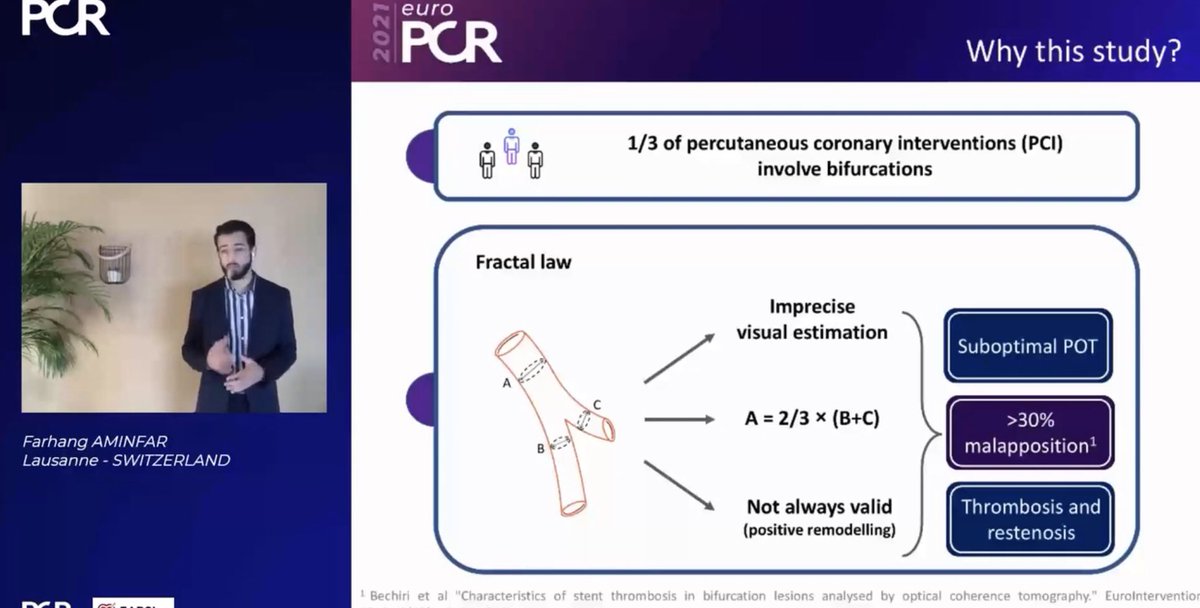 Congratulations for this victory and this beautiful study! 👏
#EuroPCR   New approach to detect malapposition. So ingenious ! 🔥 Are you ready for the POT Puff sign  ?