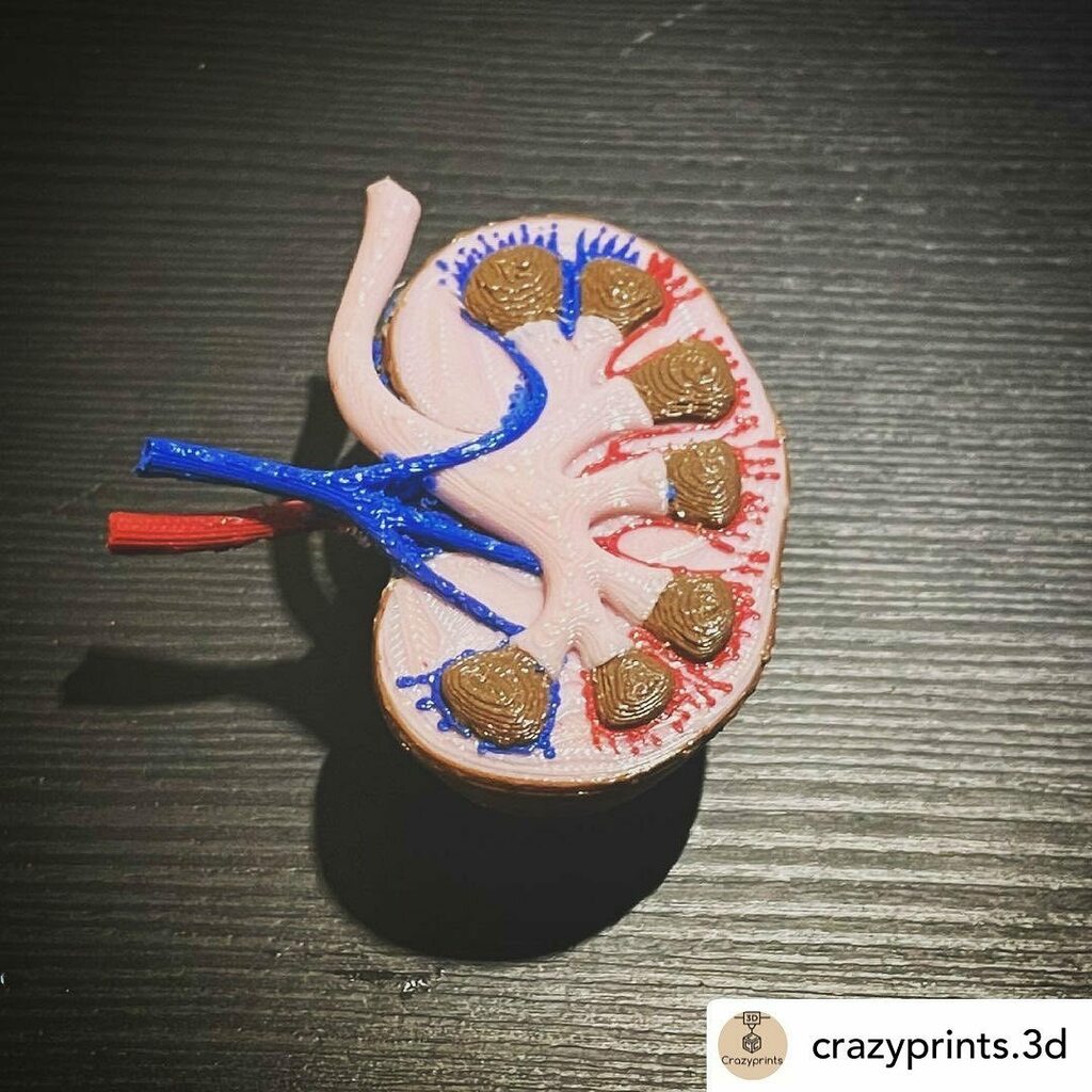 3dheals's tweet photo. #repost @crazyprints.3d Human kidney
•
Difficult multicolor print had to mix #pla with #plaplus for the right colors and print it with support structures
Deisgn by @mosaicpalette @mosaicmfg
•
#3ddesign #3dmodel #3dprints #ender3 #kidney #creality #3dprintingtutorial #3dpri… https://t.co/gy87U25pu2