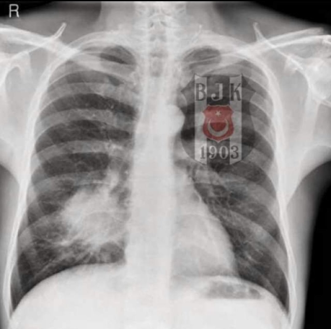 Biz BEŞİKTAŞLI değiliz, Bizim yaşam biçimimiz BEŞİKTAŞ 🖤🤍🦅🏁
#Besiktas #ArmandaSaklı #BırakmamSeni #ŞampiyonBeşiktaş