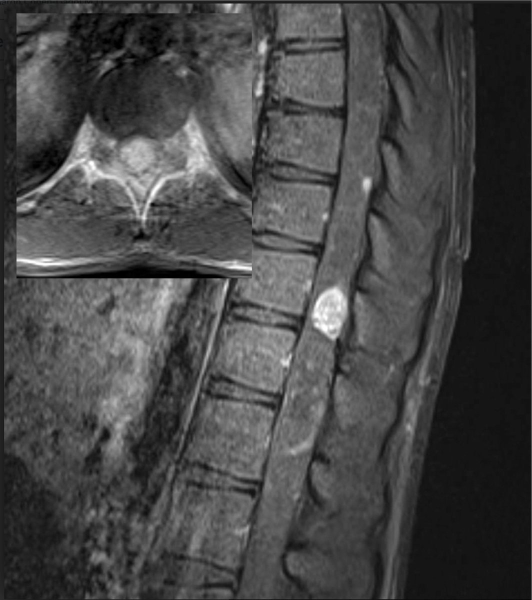 Neurosurgical Atlas tweet media