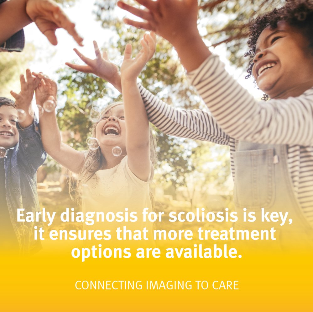 Early diagnosis for #scoliosis is key, it ensures that more treatment options are available. The EOS solution provides clear X-ray images and 3D models to help diagnosis the condition, monitor progression over time, and guide treatment strategies.  #spine #ScoliosisAwarenessMonth