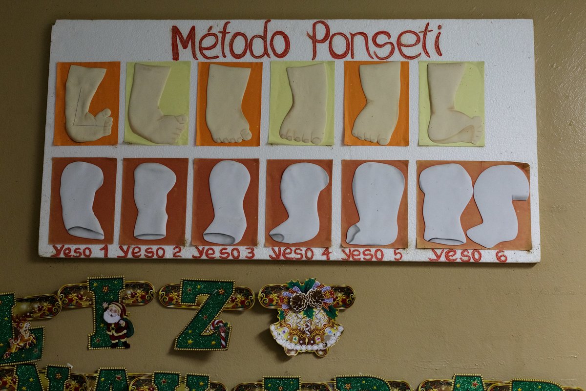 miraclefeet's tweet photo. Happy birthday, Dr. Ponseti, and thank you for your contribution to #clubfoot care and for helping transform hundreds of thousands of lives! #WorldClubfootDay #WCD21 #Ponseti #PonsetiMethod #RunFree2030 #Clubfoot #AProblemWeCanSolve #ForEveryChild #LeaveNoOneBehind https://t.co/MYD0zbReOe