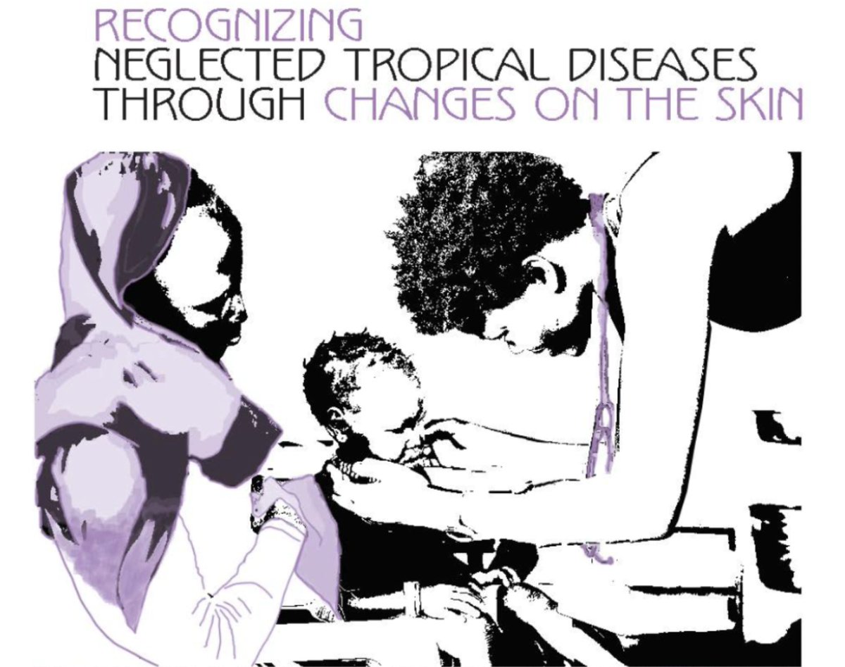 Apply work w <a href="/CatKPitt/">Catherine Pitt</a> &amp; our team <a href="/skin_africa/">Skin Health Africa Research Programme</a> <a href="/LSHTM/">London School of Hygiene & Tropical Medicine</a> economic evaluations skin #NTDs bit.ly/3yWuY1C Help shape evidence 2021-30 NTD roadmap