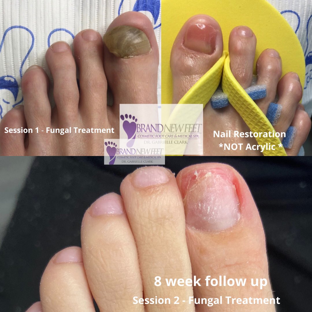👣MyBrandNewFeet👣 on Twitter: 👣MyBrandNewFeet👣 on Twitter: