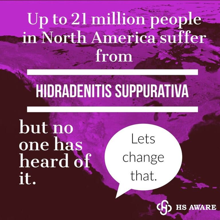 Mount_Pearl's tweet photo. #MountPearl proclaims June 7-13, 2021 as Hidradenitis Suppurativa (HS) Awareness Week.
HS is a chronic, inflammatory skin disease that affects up to 4% of the population.
Join us in increasing awareness, recognizing the struggles of those affected, and becoming #HSaware! https://t.co/C8of4JLlxF