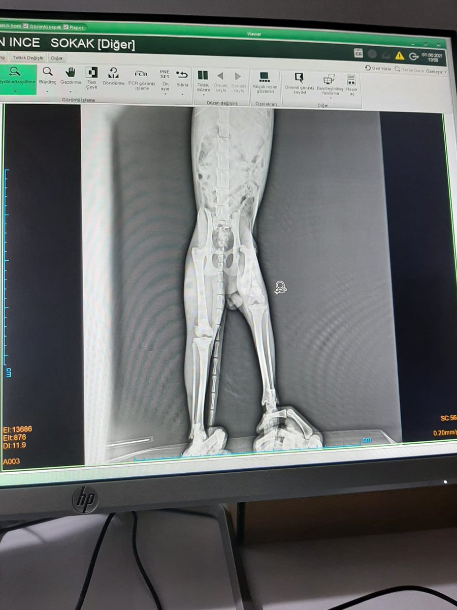 hzl litoris tweet media