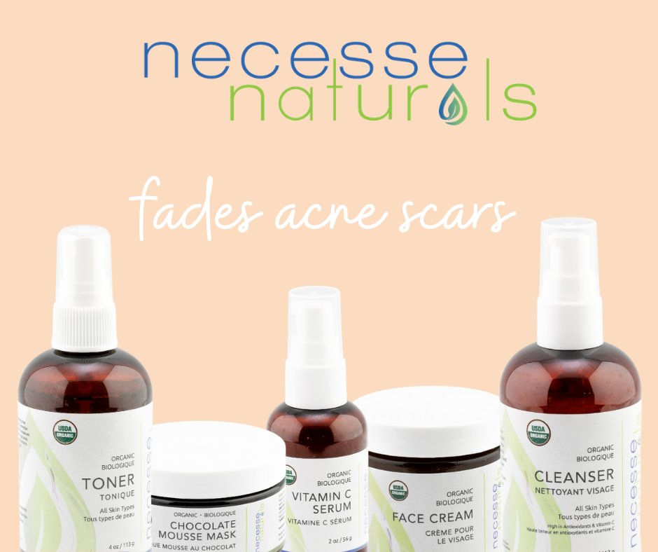 Have you suffered from acne scars for so long? Then click the link to know how to rid of acne scars!

bit.ly/3g0Ec4u