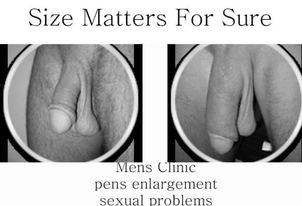 SthembiD's tweet photo. MEN'S ORGANIC PRODUCT

Attain the size you acquire with our Penis enlargement combo
*Premature Ejaculation
*Low Sex Drive
*Weak Erection.

WhatsApp
📞+27824746860 
📞+27631117460

Pretoria, Krugersdorp, Roodepoort, Soweto, Durban, Cape Town. Joburg

🚚 Post delivery via PEP https://t.co/OcQazT1k8u