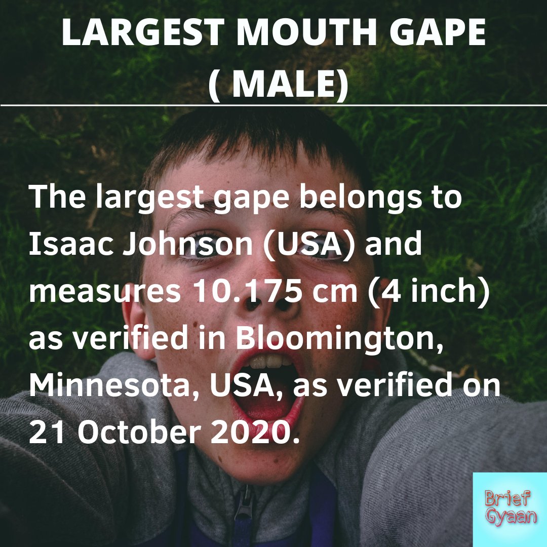 BriefGyaan's tweet photo. Largest Mouth Gap World Guinness Record.
.
.
.
.
.
#briefgyaan #worldguinessrecord #worldguinnessrecord #largestmouth #instgram #trending #gktoday #gkworld #mouth #boy #male #worldrecord #usa #american #TwitterIndia https://t.co/NP7jq1zyfI