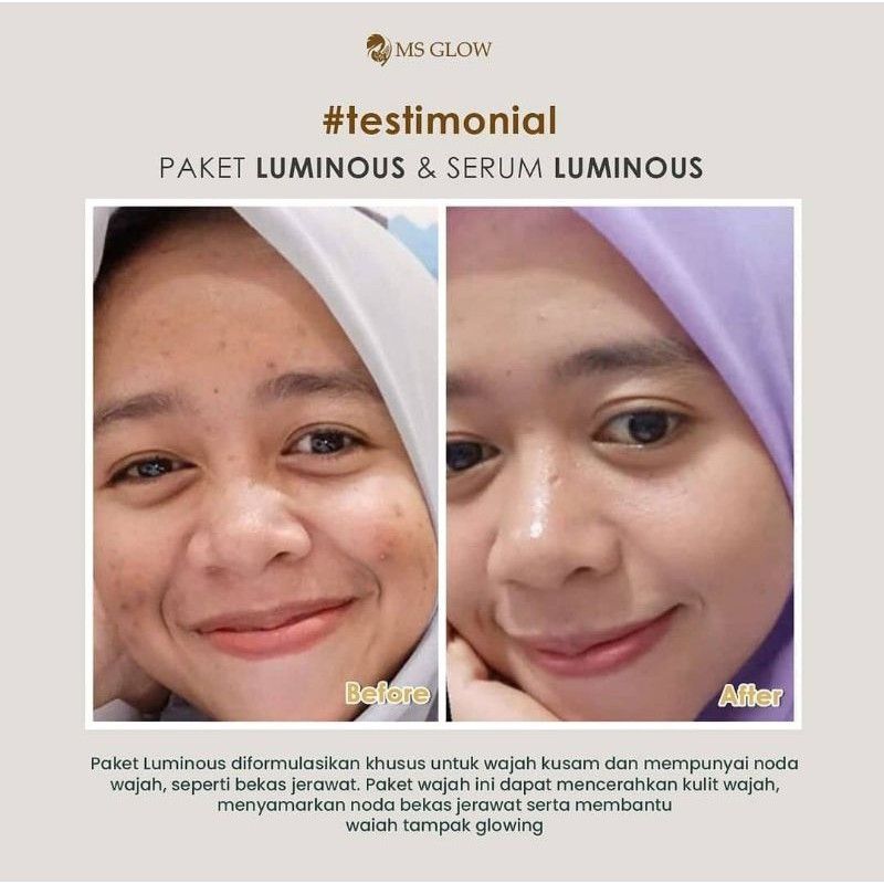 Evaanoviii's tweet photo. Saya menjual MS GLOW SERUM LUMINOUS seharga Rp. Dapatkan di Shopee sekarang! https://t.co/z4GFlLM0cm #ShopeeID https://t.co/IeiQ5VtfF3