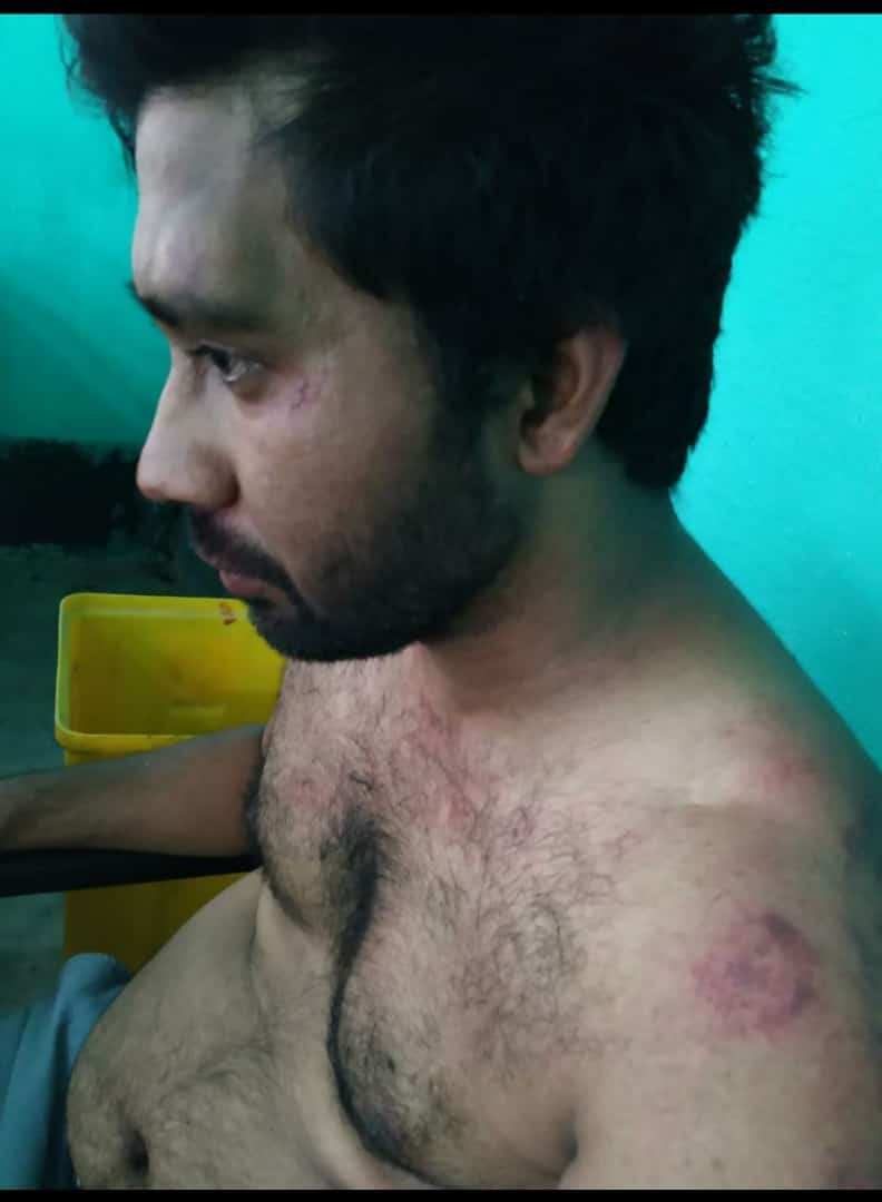Manikandanraj92's tweet photo. This doctor was brutally attacked for declaring Death of a COVID positive patient in Assam.
#savedoctors https://t.co/6hmBH3nD1h
