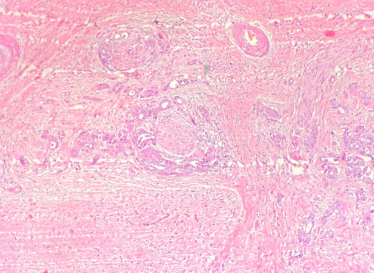 NidhinMd's tweet image. What’s happening here? #twitterpath #PathTwitter #pathresident #pathology #gastro #GIpath