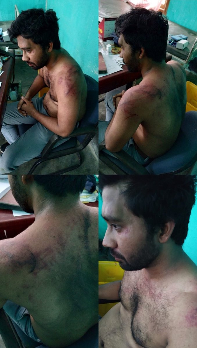 DrJagdishChatur's tweet photo. This is a patient who was a Doctor a few minutes ago. He was converted to a patient by patients (family members) he was treating. 

This is the "Treatment" Doctors are getting from Patients 😡😡and no one cares about the side effects of these treatments right? https://t.co/w1zP5IYGug