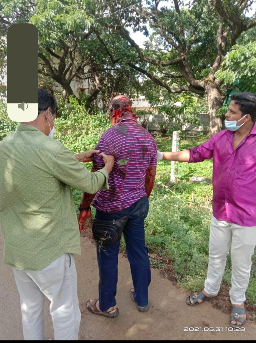 Horrifying: Dr Deepak CE was brutally assaulted on Monday by attendants of a child who died during treatment at a pvt hosp in Tarikere, Karnataka, IMA said.
He had received grievous injuries and has undergone surgery.
#AssaultOnHealthcare #BlackDayProtest #FrontlineWarriors