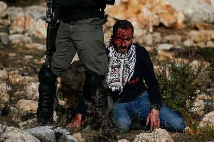 fakhrifadzli's tweet photo. Sejak bermula protes terhadap isu Sheikh Jarrah pada bulan Mei lepas, sudah 35 orang rakyat Palestin di Tebing Barat &amp; Al-Quds dibunuh oleh Tentera Zionis.

Korban terbaru ialah Fadi Wahshah yang kritikal setelah ditembak di kepala ketika demonstrasi 2 minggu lepas. #SavePalestin https://t.co/IBc3uoyv4y