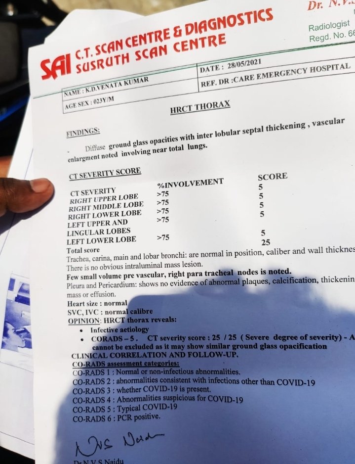nikhilpowet's tweet photo. @KTRTRS @YadavTalasani @GKamalakarTRS @revanth_anumula @SonuSood @SoodFoundation  @actor_Nikhil
@harish2you 
He is in serious sitiation.25 in CT scan.Lungs totally damaged.Needed ECMO bed and lungs transplantation.

Lost his mother and granny due to Covid.
#savedinesh https://t.co/KKy7o74xik