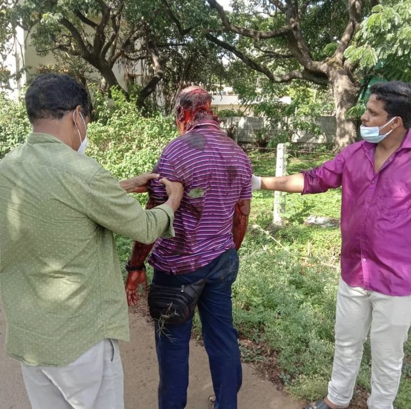 FORDA condemns yet another incident of Assault on Doctor today by patient’s attendants, this time in Karnataka &amp; demands strict action against the culprits #CentralDoctorsProtectionAct <a href="/CMofKarnataka/">CM of Karnataka</a> <a href="/mla_sudhakar/">Away promo code first order 2025</a> <a href="/drharshvardhan/">Dr Harsh Vardhan</a> <a href="/AmitShah/">Amit Shah</a> <a href="/karnatakarda/">Karnataka Association Of Resident Doctors</a> <a href="/ANI/">ANI</a> <a href="/ians_india/">IANS</a>