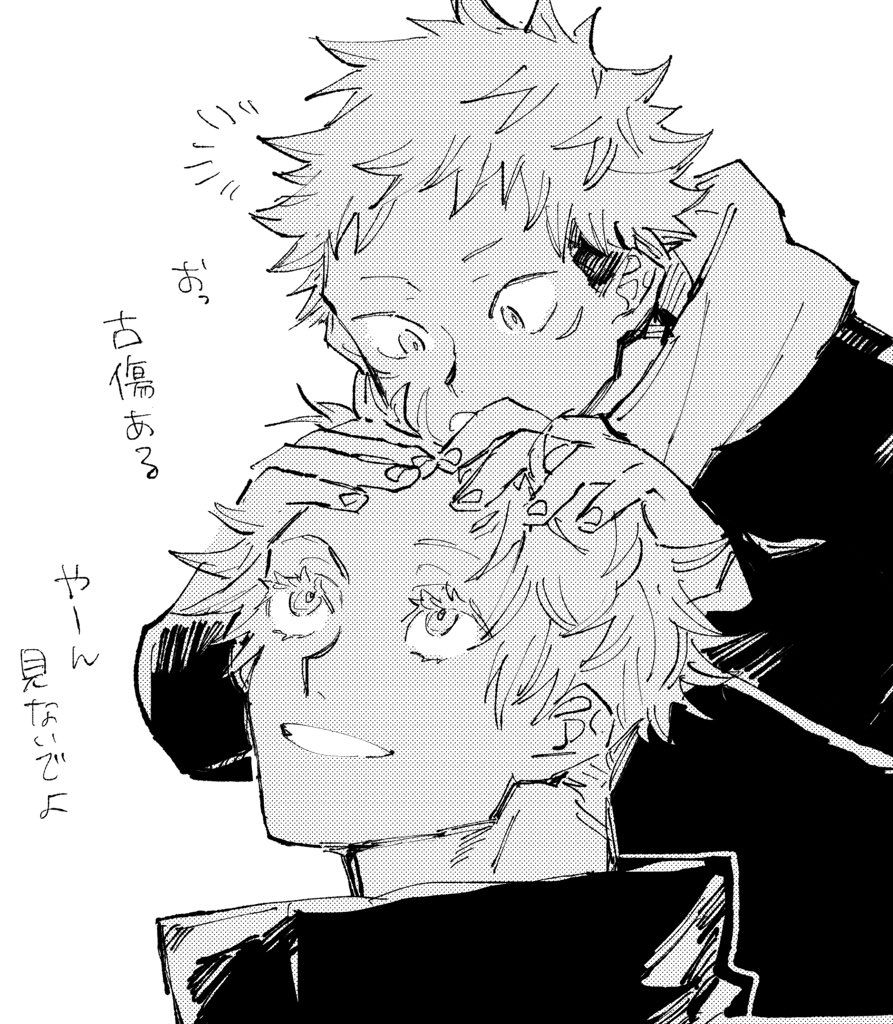 おでこ 
