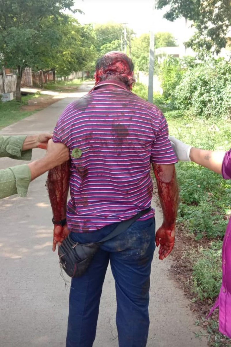 zoo_bear's tweet photo. Hey @CTRavi_BJP, A day before Assam incident, Dr Deepak from your (Chikkamagaluru) district, Karnataka was brutally attacked, Police arrested accused Venugopal, Nitin &amp; Venkatesha. Swords were recovered from the accused. Are the accused "Secularists" too? Why communalise? https://t.co/DkQswrBUHv