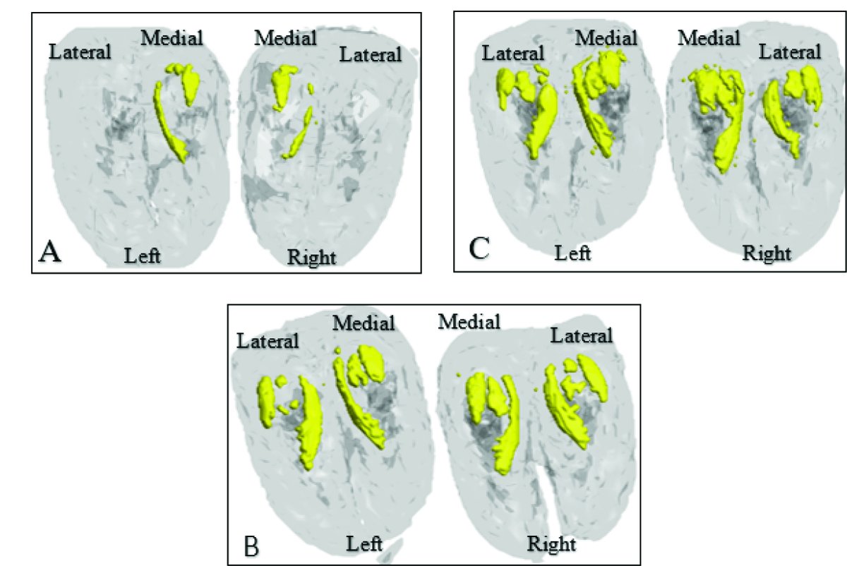 How does lameness and claw horn lesions through an animal's life impact on the structure of the digital cushion? Read research by <a href="/catrinrutland/">Prof. Catrin Rutland</a> of <a href="/UniofNottingham/">Uni of Nottingham #WeAreUoN</a> and others here:  ow.ly/wMMr50EtzVS
#dairyscience #dairyresearch