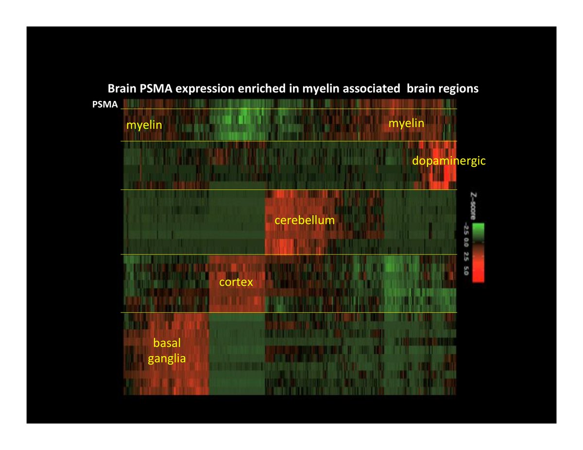 molquant's tweet image. PSMA has well known expression and function in the brain (our data links it to myelin associated regions). Consider contribution from on-target off-tumor @TmunityTx